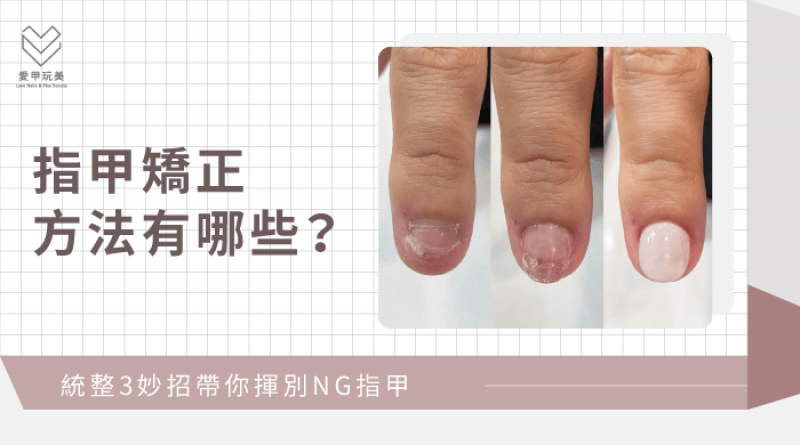 指甲矯正3個方法推薦-指甲矯正方法-台中指甲矯正