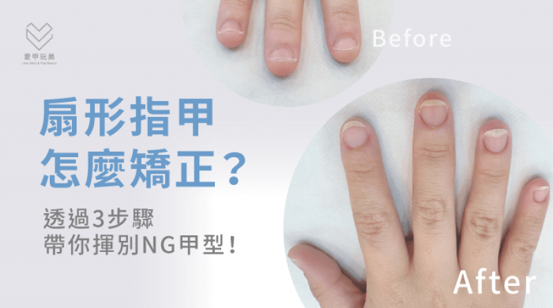 改善扇形指甲3步驟說明-扇形指甲矯正