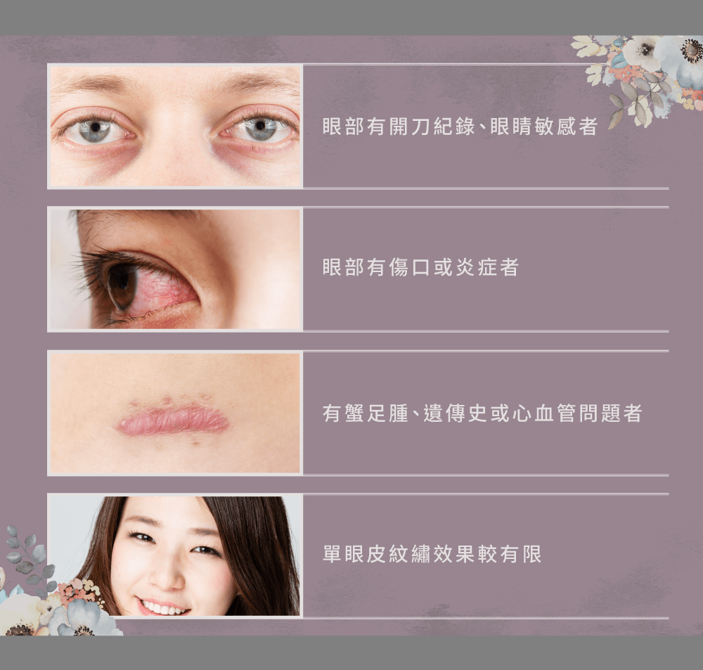 愛甲玩美美瞳線服務細膩手法,過程舒適無感 美瞳線適合對象-台中美瞳線推薦