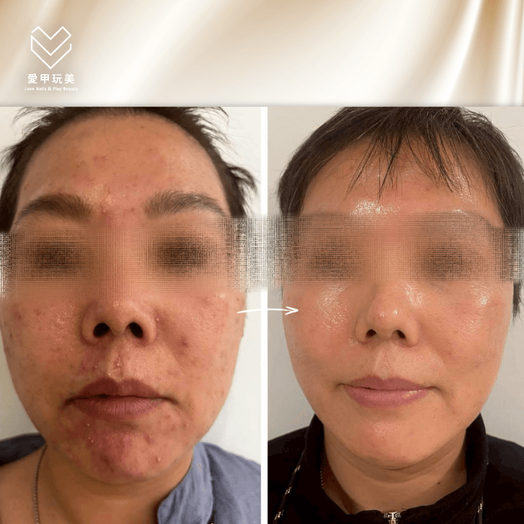 種鑽石案例-台中種鑽石