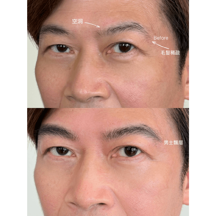 男生也能透過飄眉調整眉型 改善眉毛毛流分布不均的情形 男士飄眉-台中男士霧眉