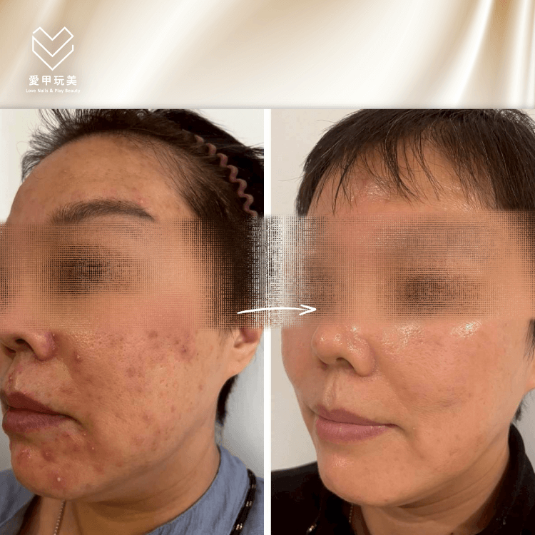 種鑽石案例-台中種鑽石