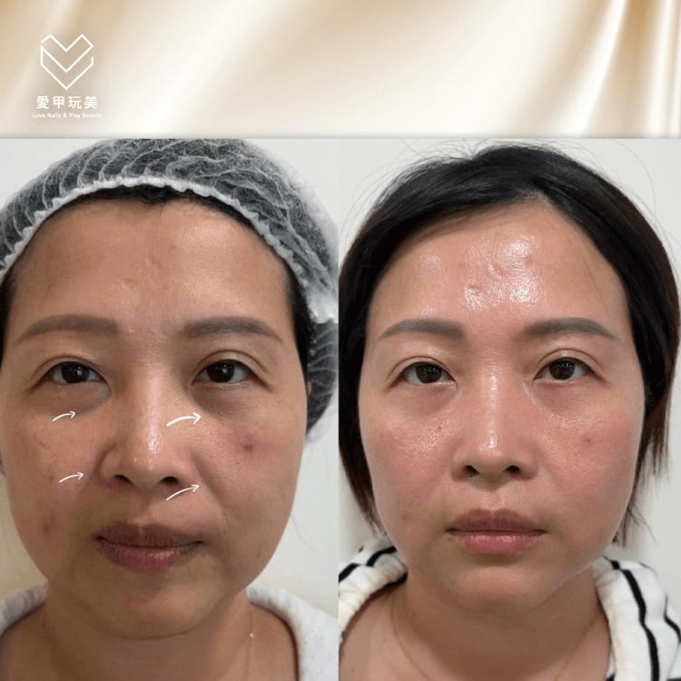 種鑽石案例-台中種鑽石