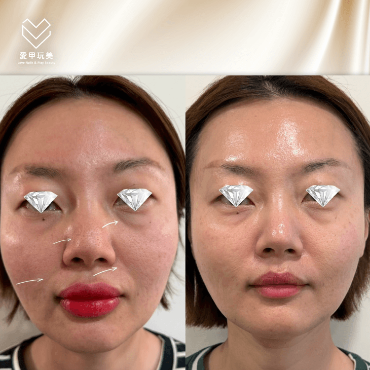 種鑽石案例-台中種鑽石