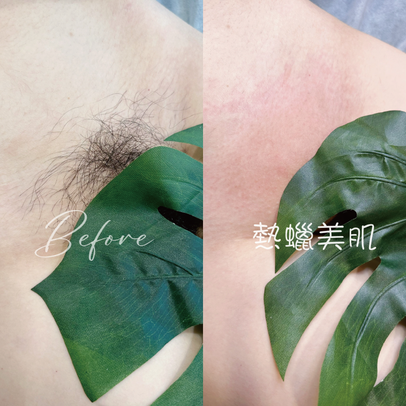擺脫生理期的黏膩感-私密處熱蠟除毛 私密處除毛-台中熱蠟除毛推薦