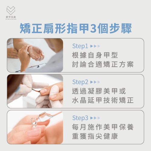 矯正扇形指甲的3大步驟-扇形指甲矯正