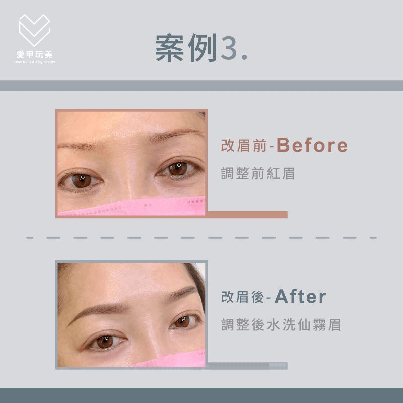霧眉失敗紅眉案例-霧眉失敗怎麼辦