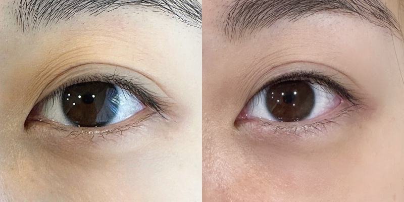 自然呈現深邃立體的眼神,讓你素顏就有明眸大眼,宛若天生麗質! 美瞳線作品案例-台中美瞳線推薦